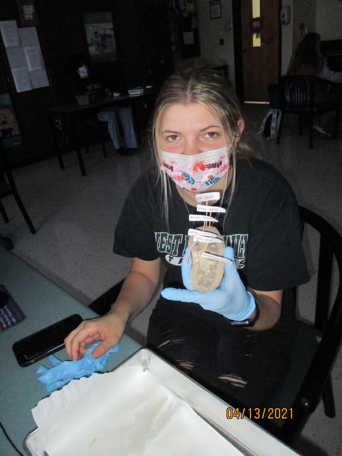 Labs Around West: Kidney Dissection