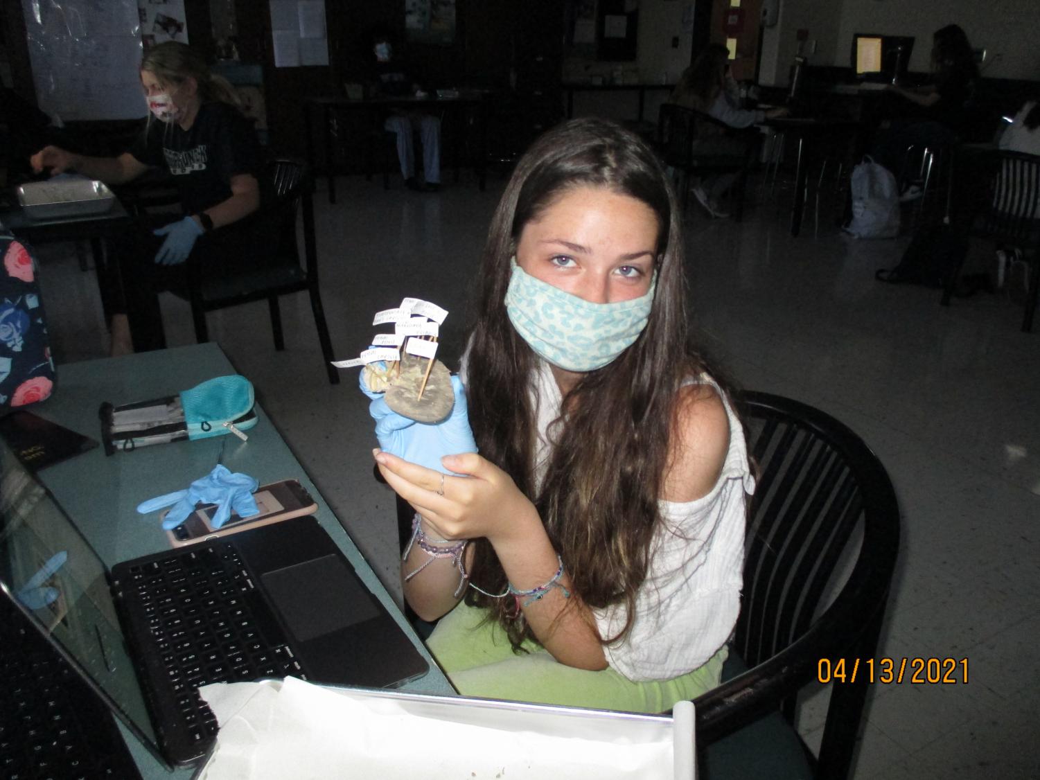 Labs Around West: Kidney Dissection
